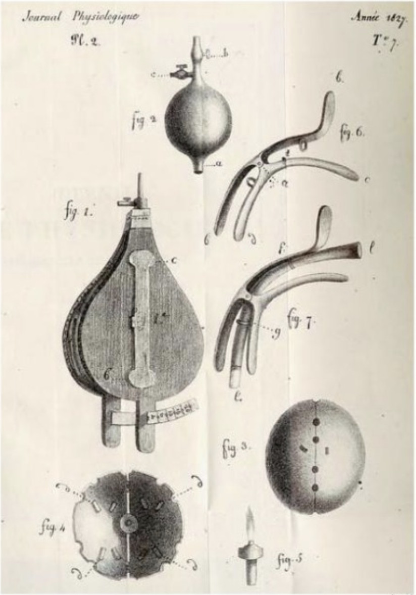 Appareil pour faciliter l’introduction de la canule dans la trachée et “soufflet calibré”
J. Leroy d’Etoilles, Recherches sur l’asphyxie, Impr. de Plassan, 1827